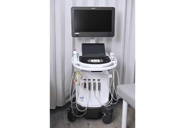 超音波診断装置